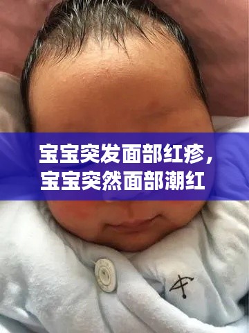 宝宝突发面部红疹,宝宝突然面部潮红